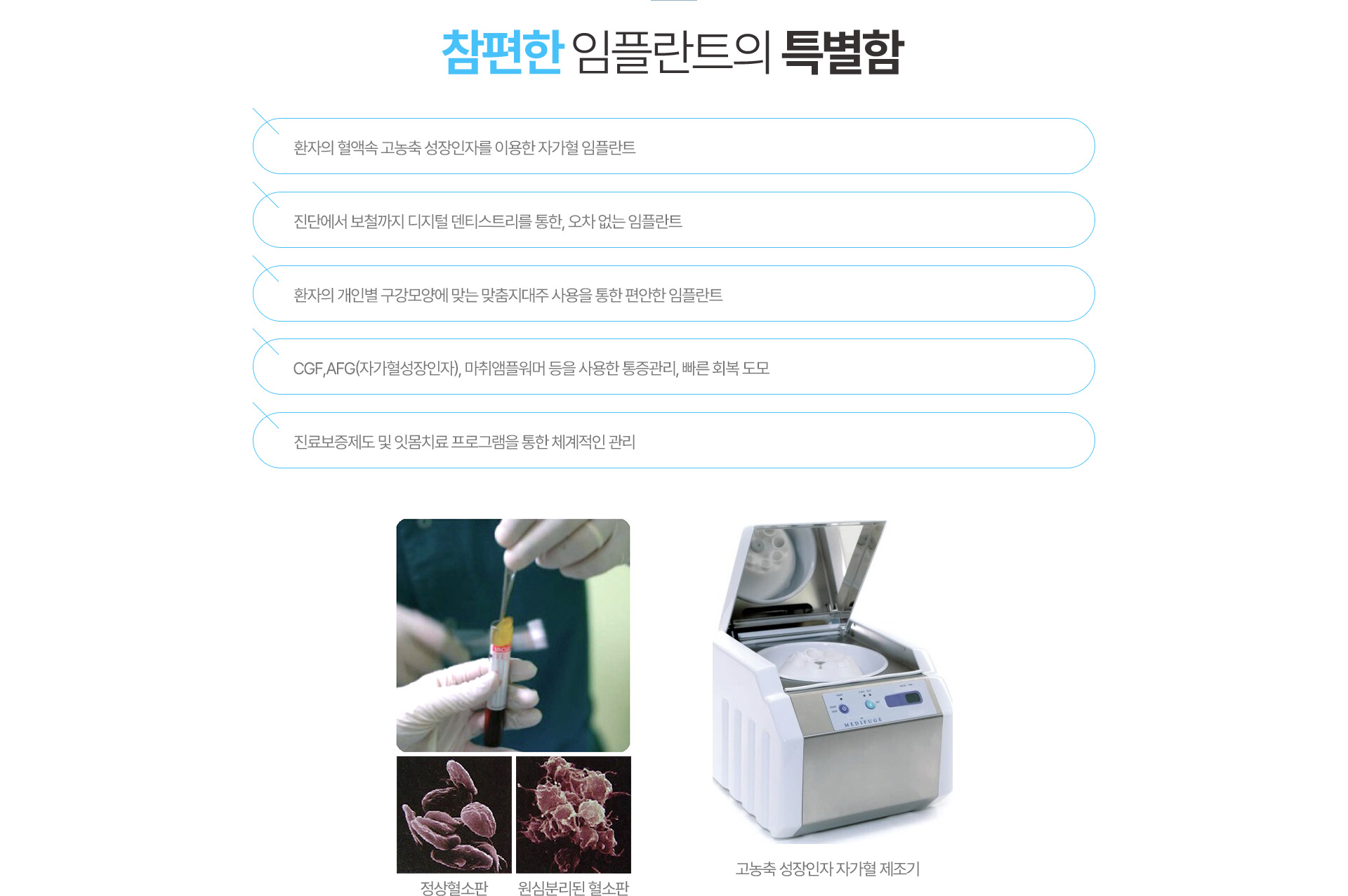 참편한 임플란트의 특별함
